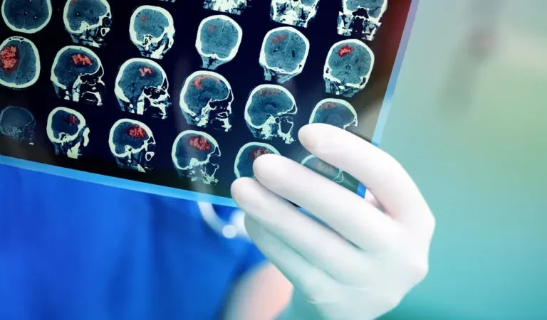 Radiography Salary in India