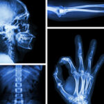 Top BSc Radiology Colleges In Chandigarh